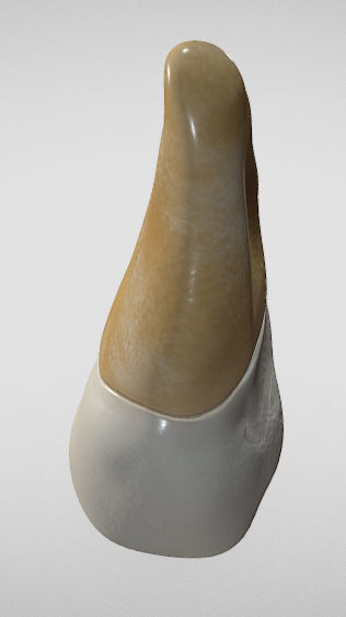 Maxillary Second Premolar Low-poly 3D model_9