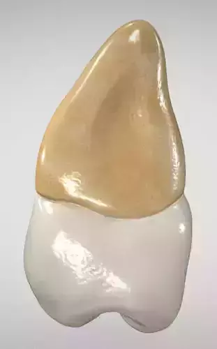 Maxillary Second Premolar