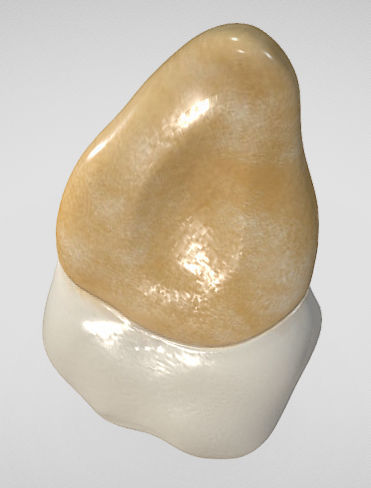 Maxillary Second Premolar Low-poly 3D model_7