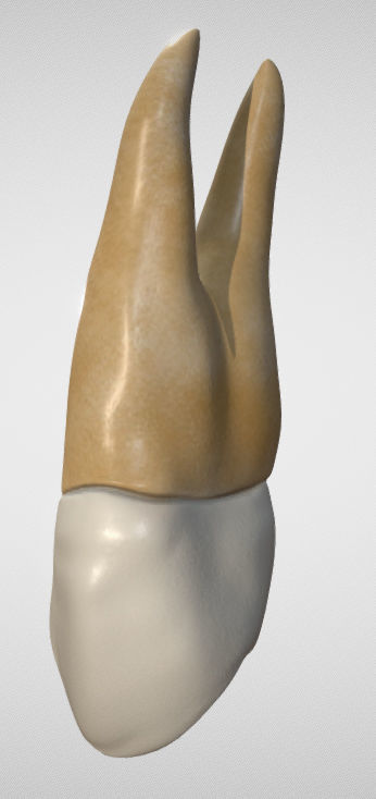 Maxillary First Premolar Low-poly 3D model_3