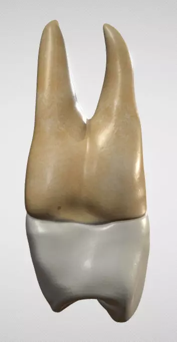 Maxillary First Premolar Low-poly 3D model_0