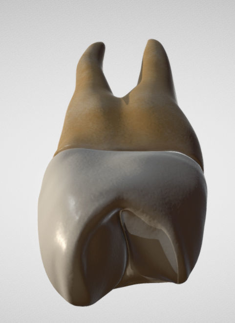 Maxillary First Premolar Low-poly 3D model_8