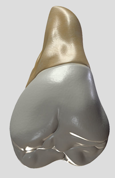 Maxillary Second Molar Low-poly 3D model_14