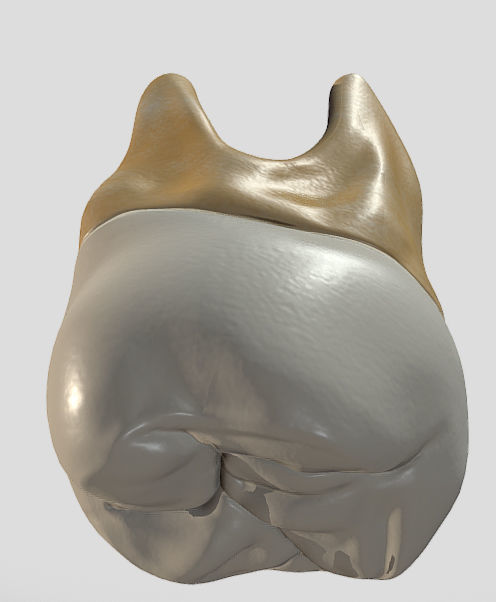 Maxillary Second Molar Low-poly 3D model_13