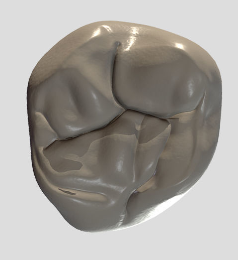 Maxillary Second Molar Low-poly 3D model_11