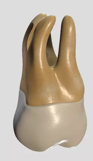 Maxillary Second Molar Low-poly 3D model_1