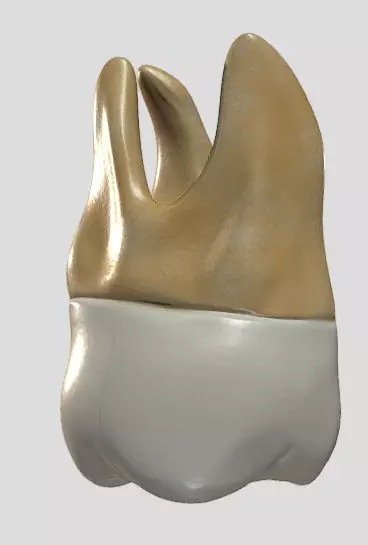 Maxillary Second Molar Low-poly 3D model_4