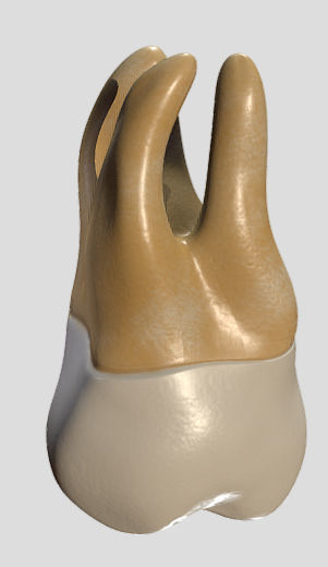 Maxillary Second Molar Low-poly 3D model_9