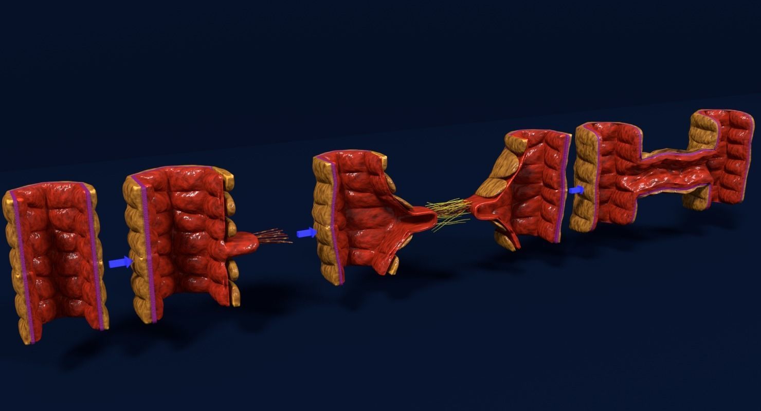 Angiogenesis human  3D model_7