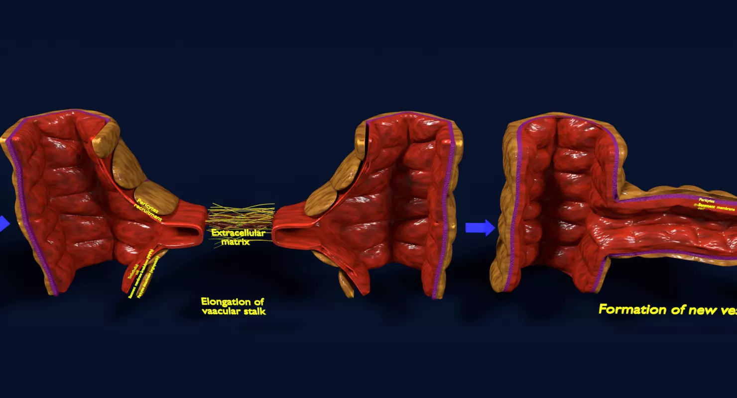 Angiogenesis human  3D model_0