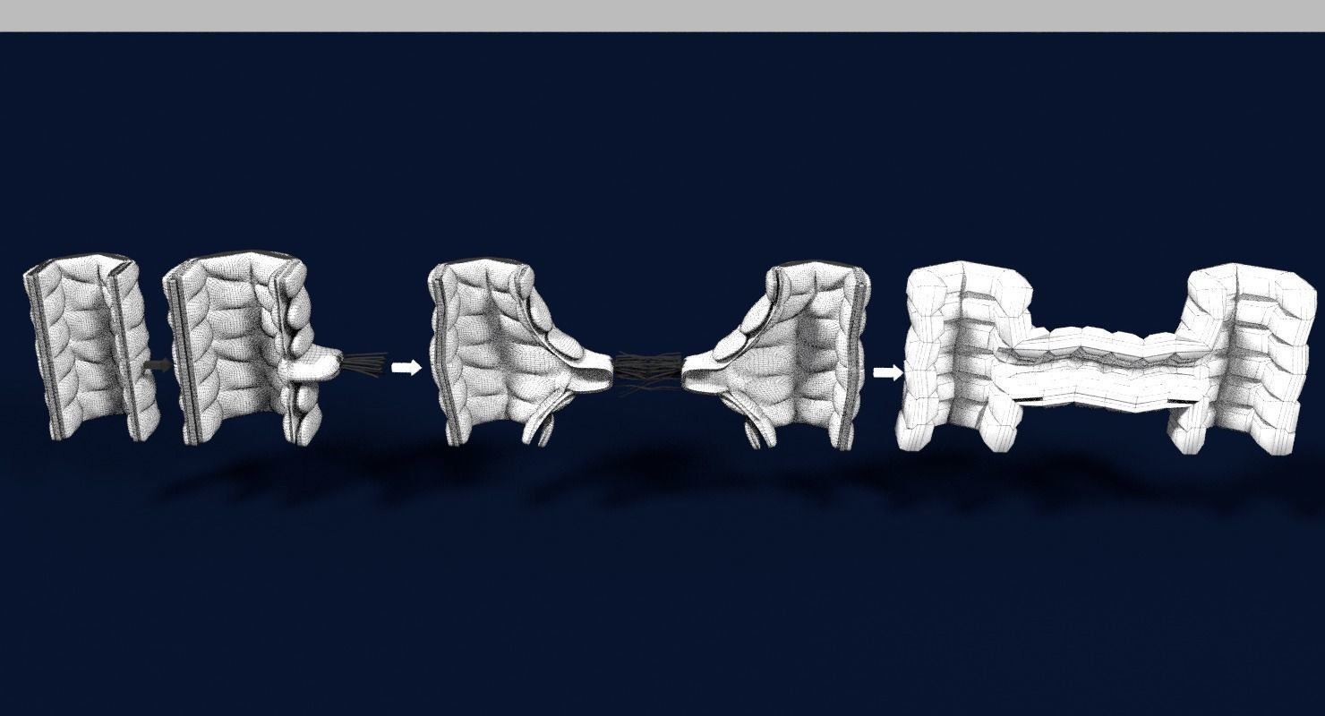 Angiogenesis human  3D model_18