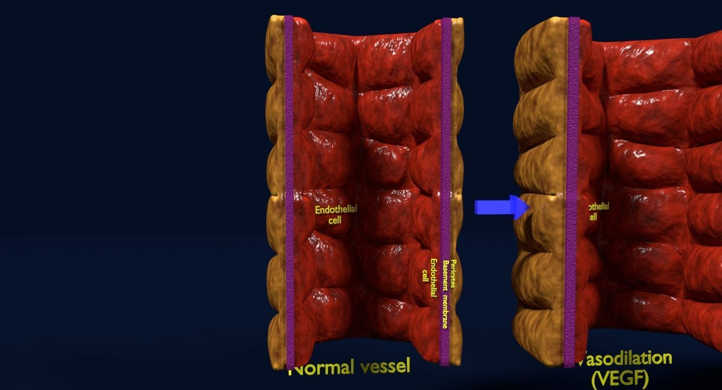 Angiogenesis human  3D model_15