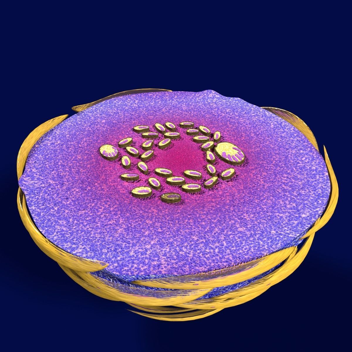 Caseating granuolma tuberculosis labelled 3D model_10