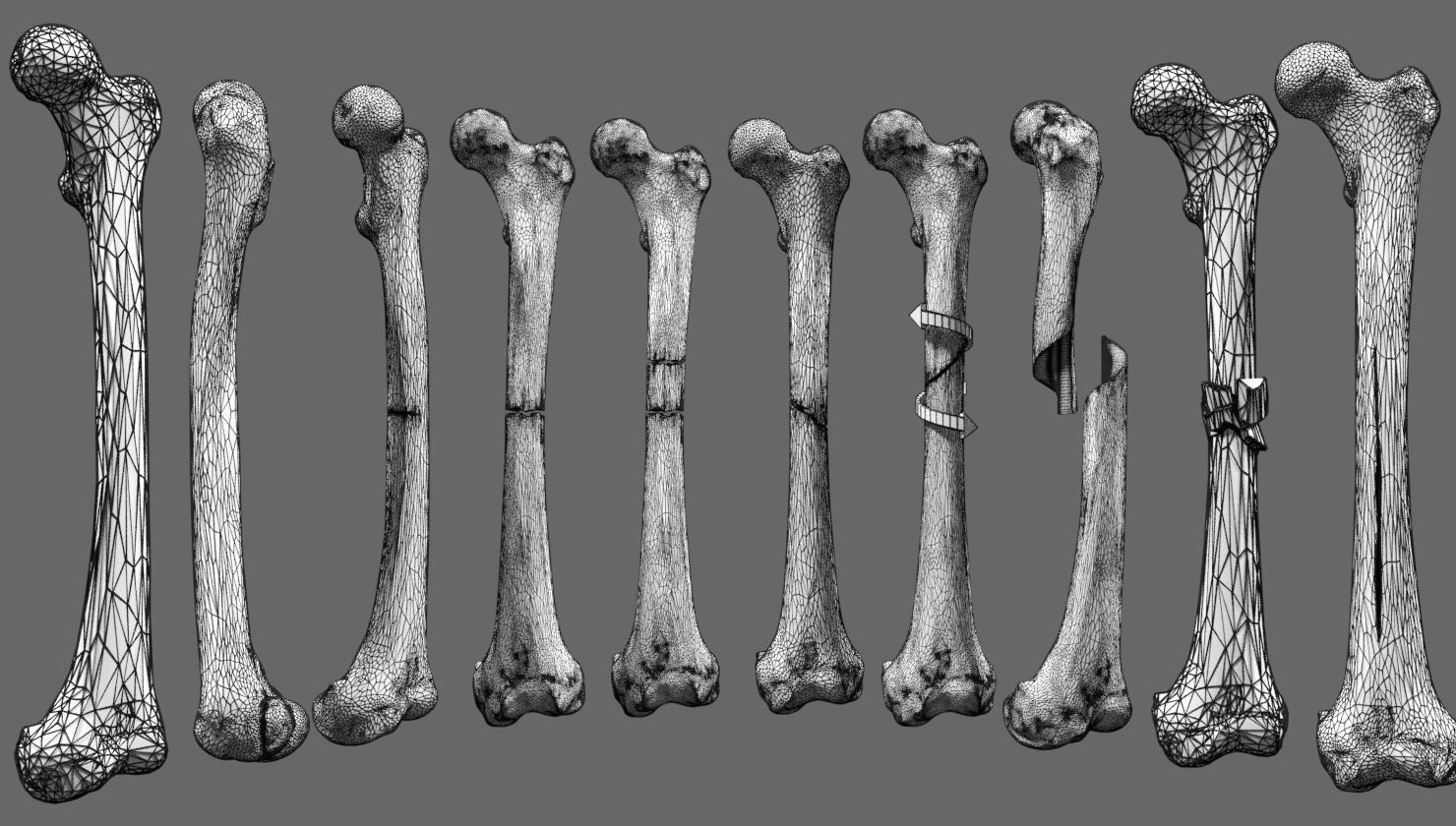 Fracture types labelled 3D model_8