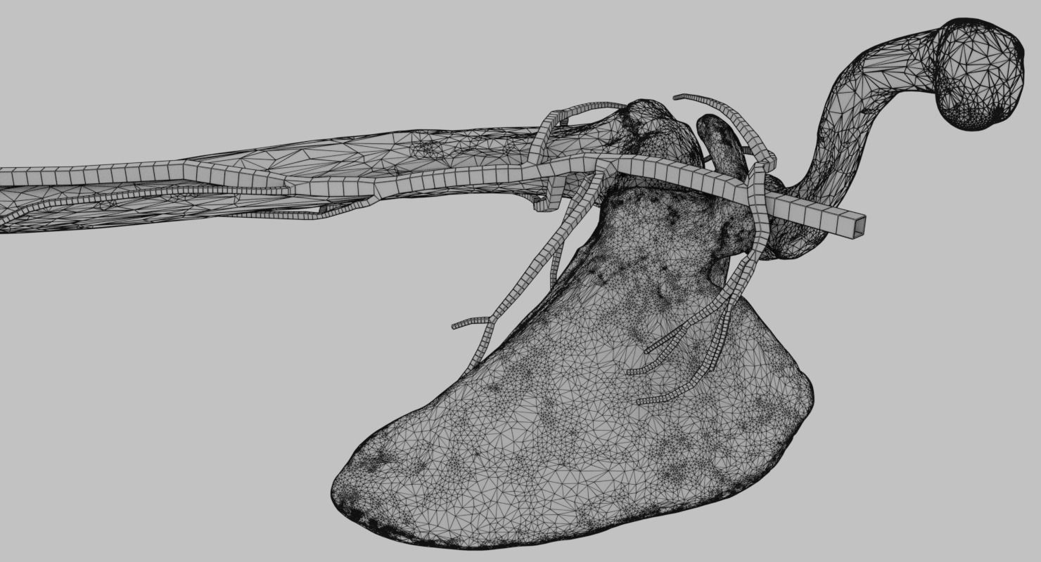 Upper limb arteries axilla arm forearm 3D model_19