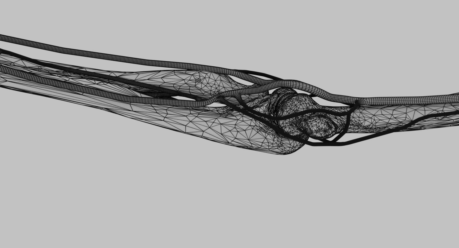 Upper limb arteries axilla arm forearm 3D model_21