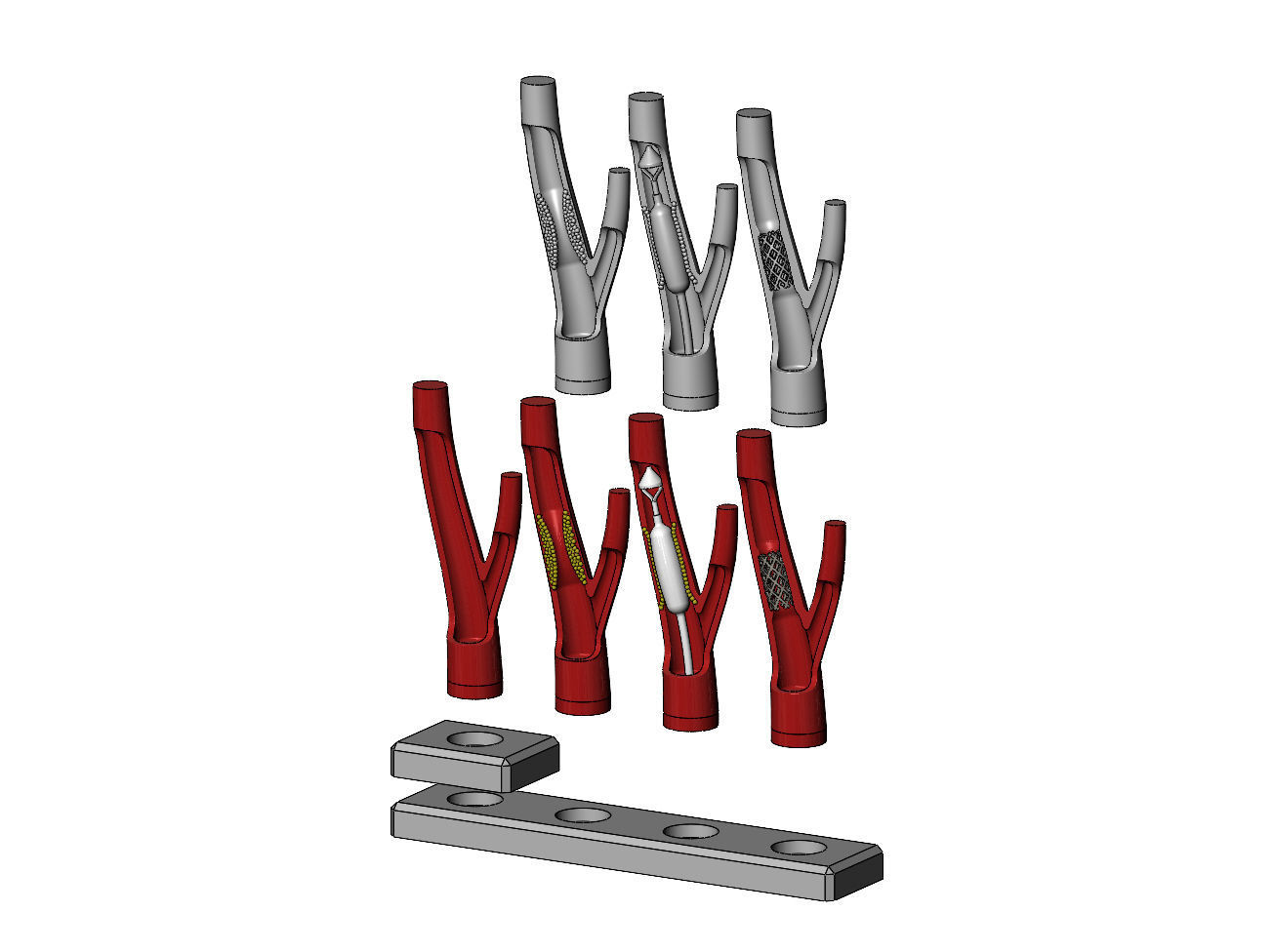 3d printable  Carotid artery stenting procedure diorama 3D print model_6