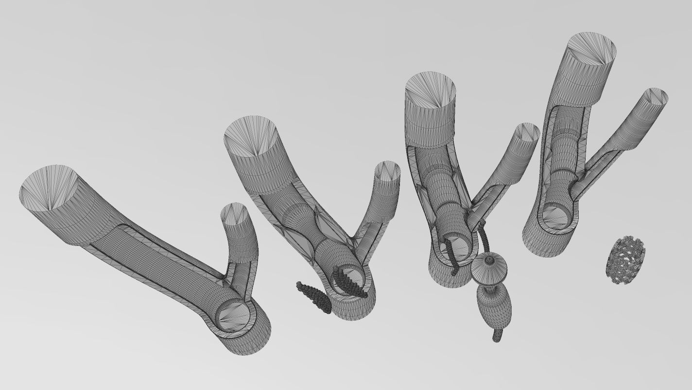 3d printable  Carotid artery stenting procedure diorama 3D print model_16