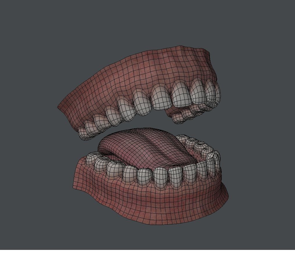 Teeth human mouth with missing Low-poly 3D model_4