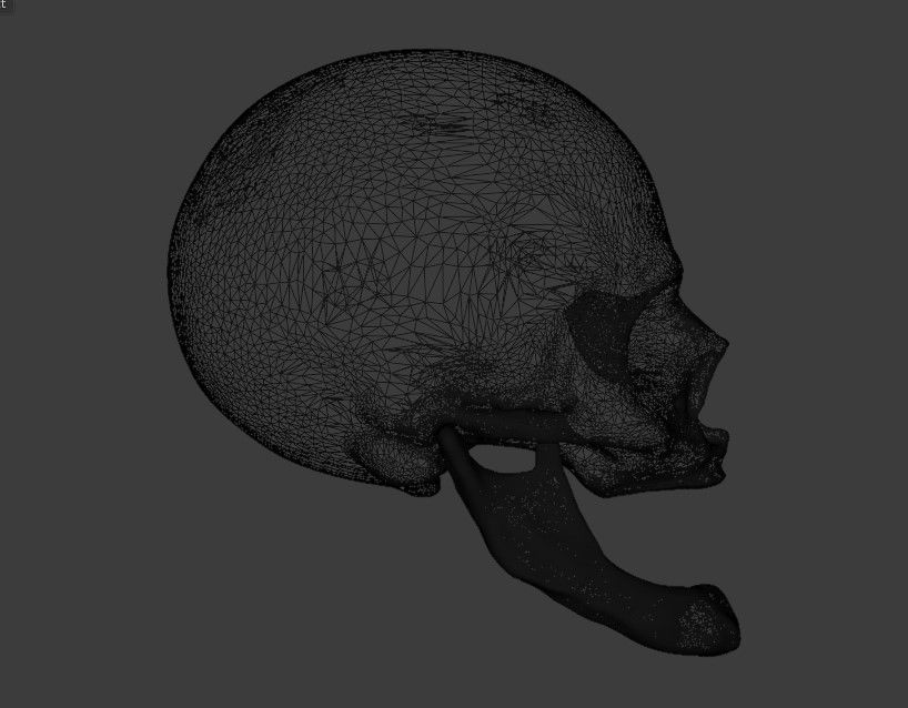 Edentulous skull 3D model_5