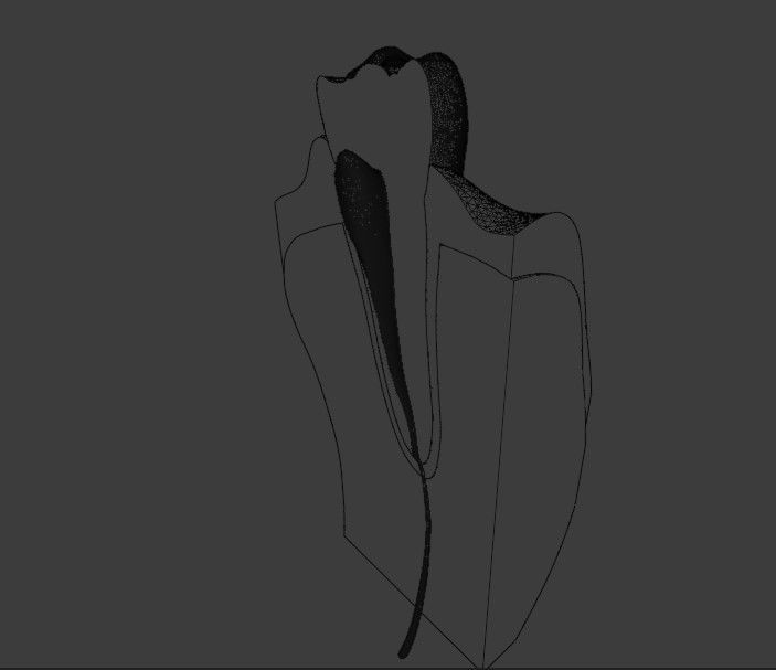 Tooth anatomy - Periodontal region 3D model_7