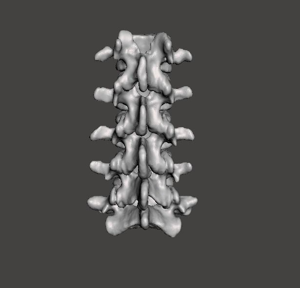 Lumbar Vertebrae  - female - age 30 3D model_10