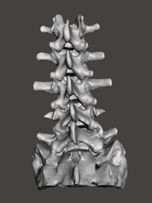 Human Lumbar Vertebrae   - male 3D model_10