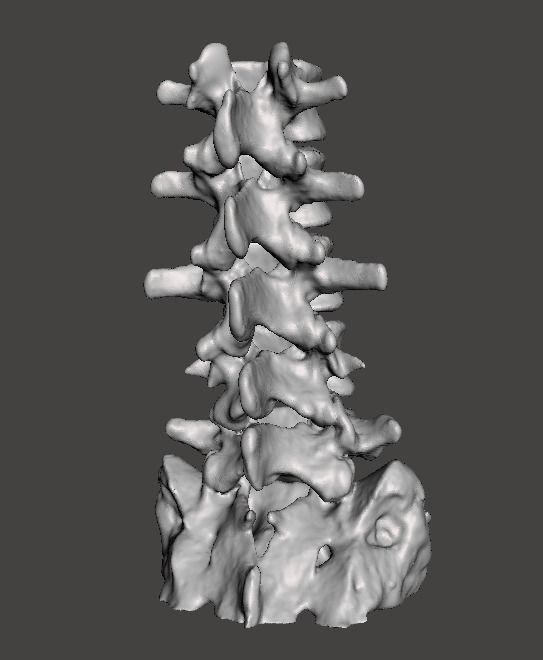 Human Lumbar Vertebrae   - male 3D model_8