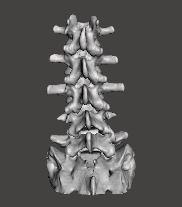 Human Lumbar Vertebrae   - male 3D model_3