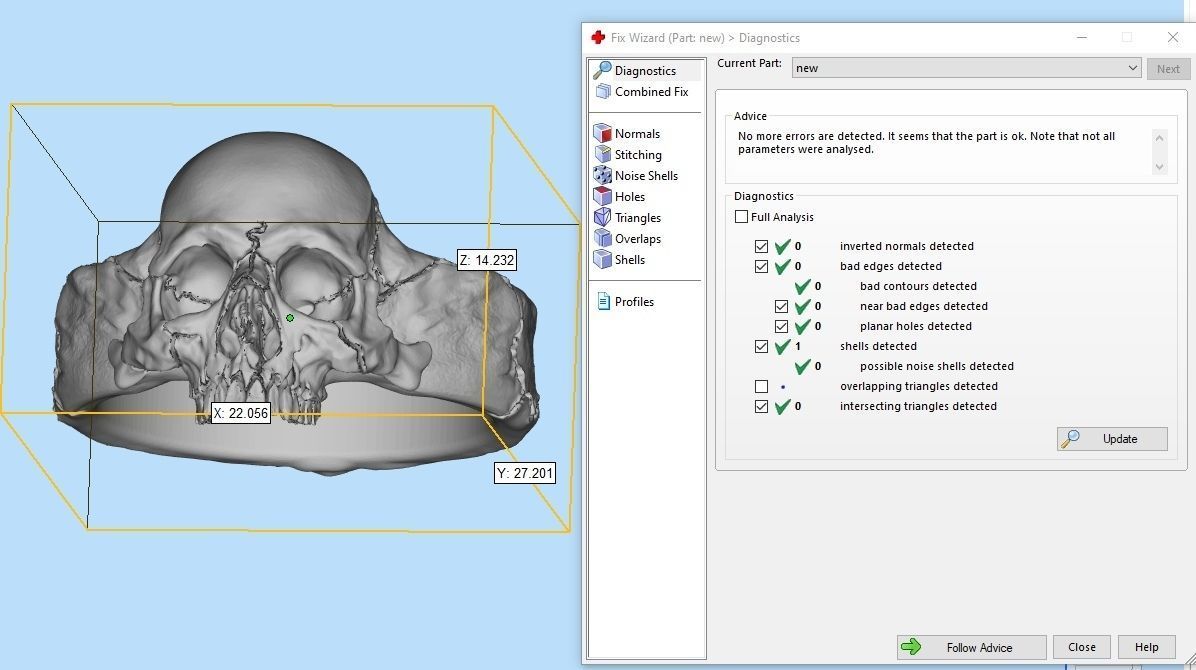 skull ring  3D print model_21