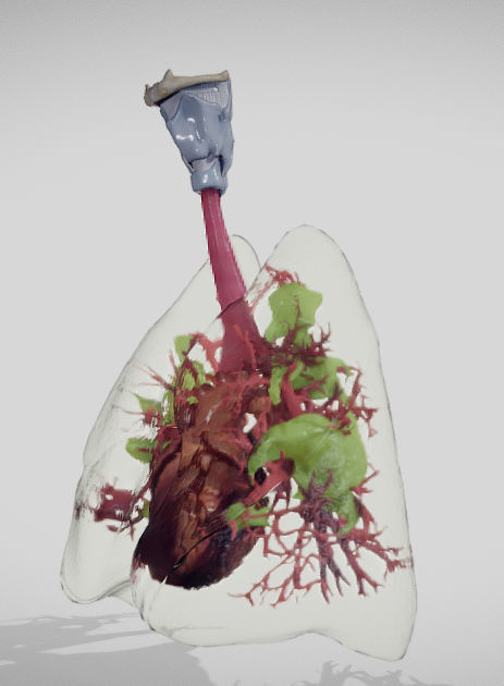 Covid 19 Lung disease Version2 Low-poly 3D model_7