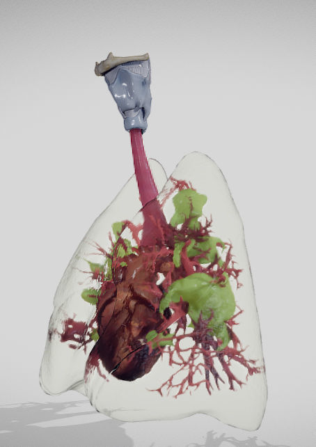 Covid 19 Lung disease Version2 Low-poly 3D model_8