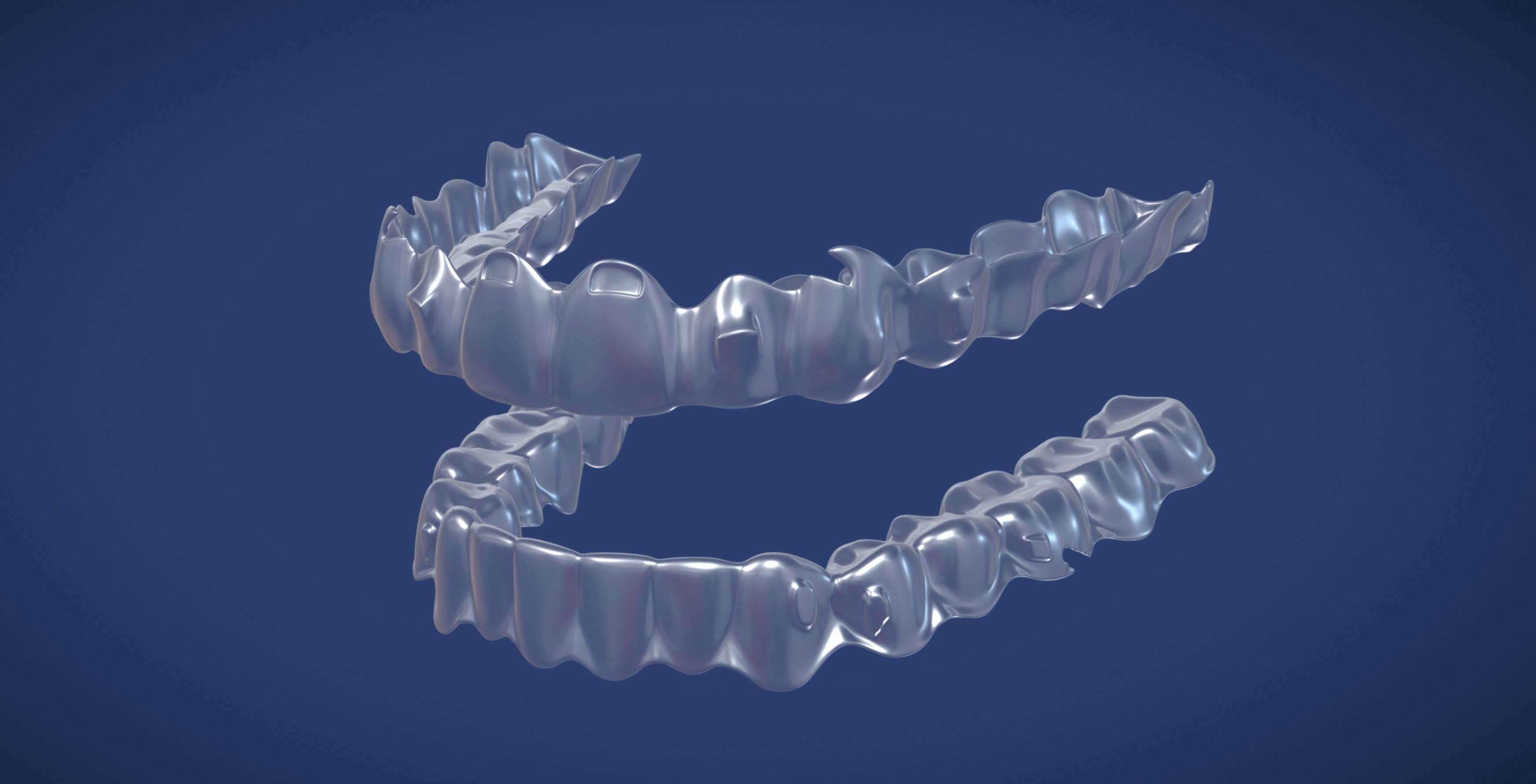 Teeth aligner Invisible braces 3D model_2