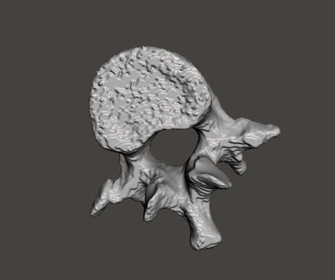 Lumbar Vertebra   L1   - male  3D model_0