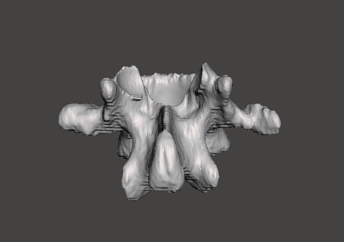 Lumbar Vertebra   L1   - male  3D model_9