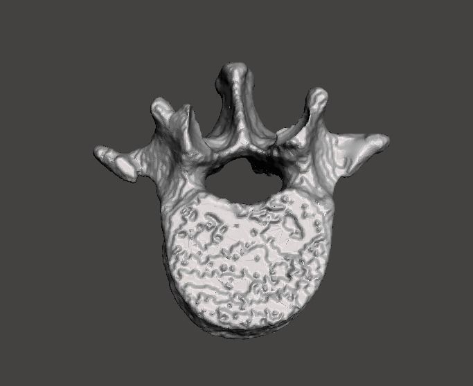 Lumbar Vertebra   L1   - male  3D model_11