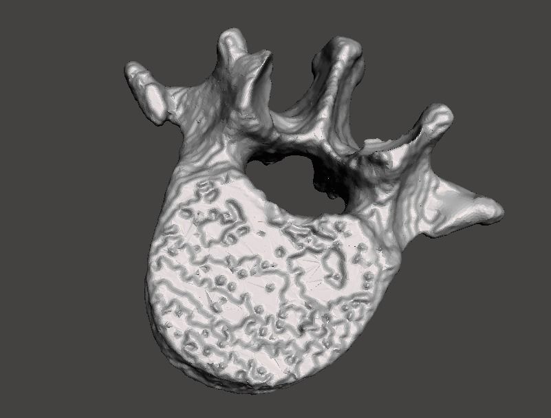 Lumbar Vertebra   L1   - male  3D model_5
