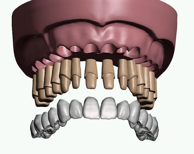 Maxillary dental model prepped dies and crowns 3D print model