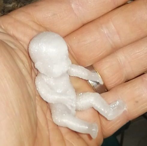 3d Baby Boy and Girl Scanned  3D print model_1