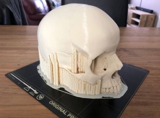 Human skull 3D print model_2