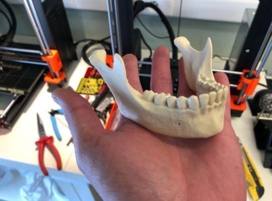 Human skull 3D print model_1