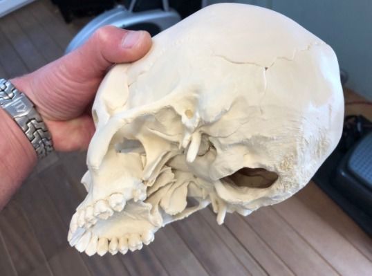 Human skull 3D print model_6