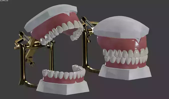 Dental Prosthesis