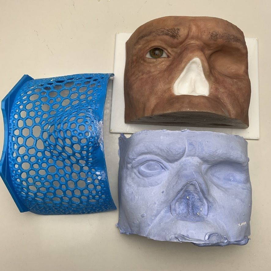 Mold for Maxillofacial prosthetic work model 3D print model_9