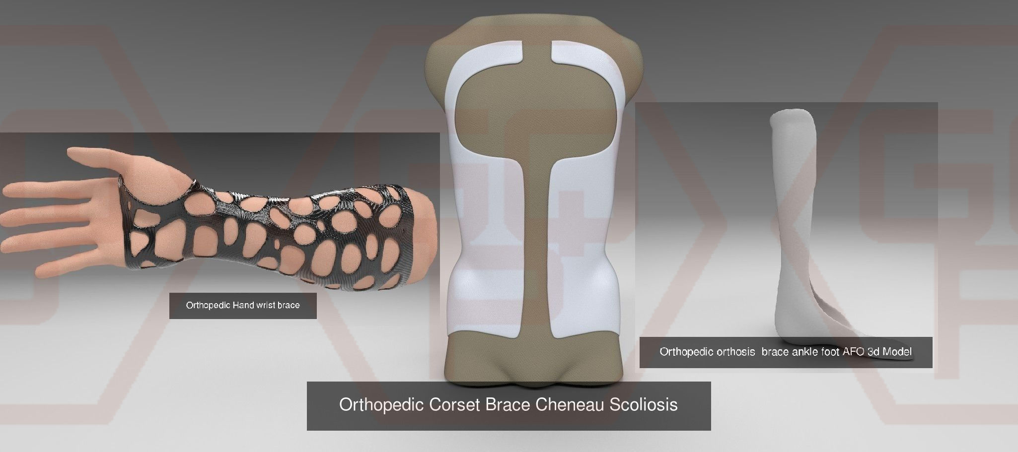 Orthopedic corset Orthopedic AFO Orthopedic wrist brace 3D Model Collection_20