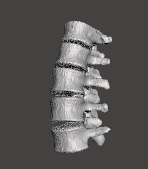 Lumbar Spine - male 3D model_2