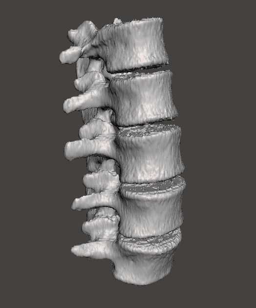 Lumbar Spine - male 3D model_0