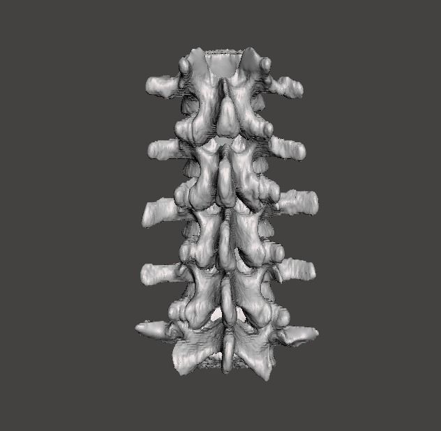 Lumbar Spine - male 3D model_4