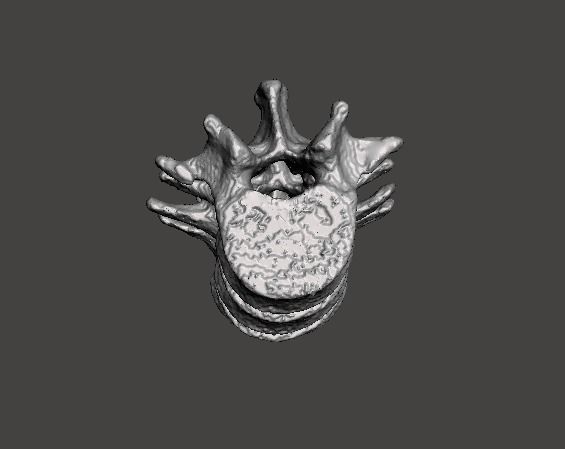 Lumbar Spine - male 3D model_8