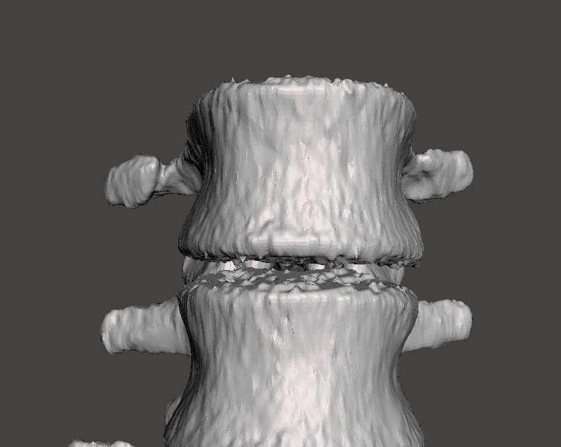 Lumbar Spine - male 3D model_9